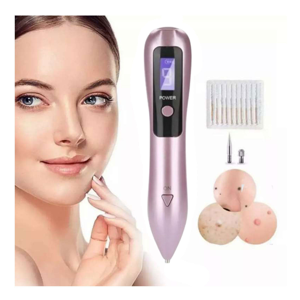 SkinLaser - Cauterizador Recargable Quita Verrugas